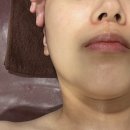 학정로 439 | 대구 동천동 에스테틱 '정명순 내면미용' 피부 관리 솔직 후기