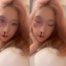 빌리 스토리 이미지