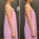 인지사거리 | 미아사거리 웨딩팔뚝관리 여름철 팔뚝관리는 헤리티지스파 미아점에서 &lt;빼드림샷&gt;