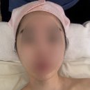 작은 얼굴 관리 구로 신도림 에이치앤비 솔직후기