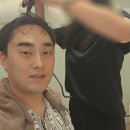 세현성형외과 | 남자 이마축소술 + 이마거상 후기