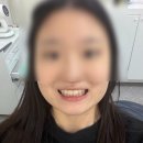함께하는치과위드치과의원 | 당산치아미백관리받고 하얘진 후기 당산치과추천