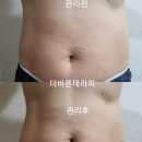 더바른테라피 이미지