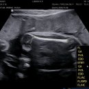 리베르여성병원 이미지