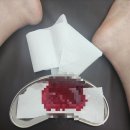 수광한의원 네이버블로그