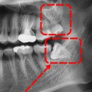 이하루치과의원 이미지