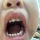 진영권치과의원 | 진영 마미치과 두돌 아기 첫 검진 후기🦷 키즈카페 같은 분위기+친절한 진료까지! 충치없는 유치 관리법...