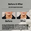 현대한의원 | 강남 안면비대칭교정 한의원 후기