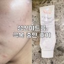성인여드름(모낭염, 화농성 여드름, 좁쌀여드름) 극복 중인 후기 - 재생크림 아벤느 시칼파트 크림 리뷰