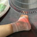 온누리대학약국 | 발목MRI 가격 비용 주의사항 보험적용된 후기