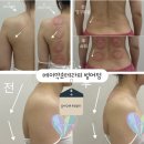메이약손테라피 이미지