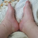 남동대로 774번길 | 다산했던 쌍둥이 임신과정과 출산후기(임신중독증으로 33주6일 출산)