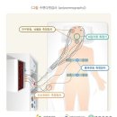 특정수면검사(수면다원,다중수면잠복기)지원비(연간1회한,급여) (간편,갱신형) 특별약관 이미지