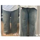 오산세종병원 | 대전 세종 허벅지 지방 추출주사 12주차 리얼후기