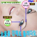 아빠의 아빠가 되는 지옥 같은 간병지옥~치매 이미지