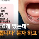 ﻿"치아 6개 뺐는데"…'폐업합니다' 문자 보내고 잠적한 치과 / JTBC 사건반장 이미지