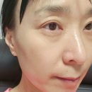 미가랑스킨케어 네이버블로그