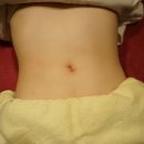 멍테라피 이미지