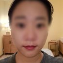 민정비디오 | 일산 에스테틱 웨딩케어, 윤곽관리 전문 아그니아 일산점