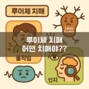 더루이체