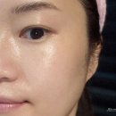 탐라테라피앤아로마앤스킨케어 | 수성구스킨케어 잘하는 곳, 봄스파앤테라피 콜라젠 토네이도 스킨케어 후기