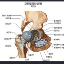 인공관절(견/고)치환술 대상질환 분류표[별표65][인공관절(견/고)치환술(연1회한)(갱신형)보장 특별약관] 이미지