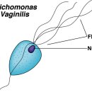 사랑의 불청객 트리코모나스 질염이란 어떤 질환일까요? 이미지