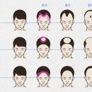 발기부전 겁내면 당신 손해다…의사도 먹는 &#39;2만원 탈모약&#39; 이미지