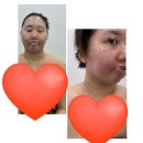 대구뷰티샘 - 달서구 당산로 81 | [대구 윤곽관리] 프링뷰티 3V윤곽테라피 후기✨ 얼굴라인+피로회복 한번에!