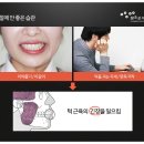엠비씨(MBC)치과기공소 네이버블로그