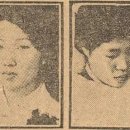자기치아살리기드림플란트치과의원 | 잇몸병, 치주질환 II