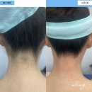 유블링 이미지