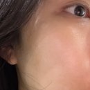 본에스테틱스킨&바디 | 광주 화정동 프레쉬 스킨앤바디 에스테틱 데콜테 mts 웨딩관리 처음 받아본 솔직 후기