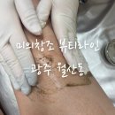 대남대로2L | 광주 허벅지 필링 솔직후기 * 광주 남구 월산동 미의창조뷰티라인