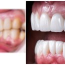 훈 기공소 이미지