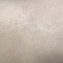 일루젼 | 범계 튼살커버 일루젼스칼프 안양 두피커버 가격 후기