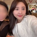 신논현역피부과 릴리쥬(릴리이드+리쥬란힐러) / 통증,시술후멍,부작용,가격 등