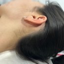 6635 | 합정역 왁싱 디크왁싱 | 본식 앞둔 예비신부 웨딩왁싱 패키지 받은 솔직 후기