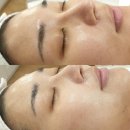 리움메디칼 이미지