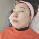 {창원북면감계} 묵은각질 잔털 노폐물제거 솔직후기 창원실크플래닝 미앤미뷰티