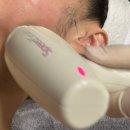 로데오 | 튠페이스 효과, 튠라이너까지 함께 받은 찐 후기(압구정로데오 피부과)