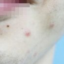 리츠피부과의원 이미지