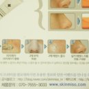 미소스킨 이미지