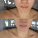 연세예스약국 | [부천/상동피부관리] 얼굴 경락 전문 &#34;더예쁠예정&#34; 솔직후기