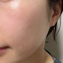 지.이.엠 | 비싼 피부과 관리 집에서 | 글로우엠 크라이오소닉 프로 내돈내산 후기
