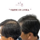 콤마더문영주점 | 부평두피문신 인기 있는 이유