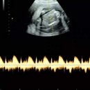 오나정산부인과의원 이미지