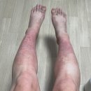 광교서울한의원 | 수원 광교 한의원에서 출산 후 산후조리 산후보약 먹고 대만족 했어요