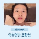 포항에스테틱 추천 후기💆‍♀️ 광대라인 살리고 싶다면? 포항피부관리로 약손명가 강추
