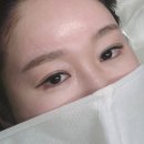 아늘 | 자연스럽고 디자인 예쁘게 애교살 음영 받은 후기!! 건대 애교음영장인 아늘